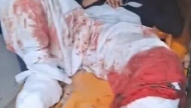 माँ ने बेटी को मोबाइल चलाने से रोका तो गुस्साई बेटी ट्रेन के आगे कूद गई.. एक टांग गँवाई।