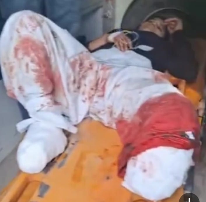 माँ ने बेटी को मोबाइल चलाने से रोका तो गुस्साई बेटी ट्रेन के आगे कूद गई.. एक टांग गँवाई।