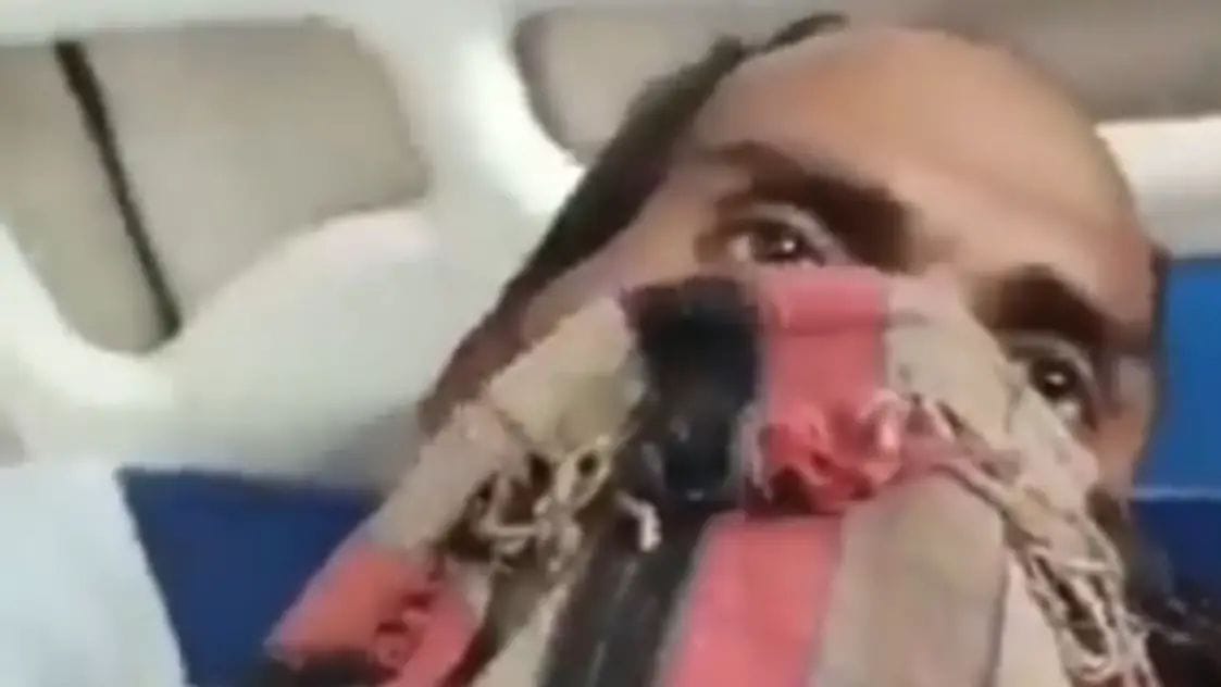 महिला ने पड़ोसी का प्राइवेट पार्ट काटकर किया अलग, सामने आया हैरान करने वाला मामला।